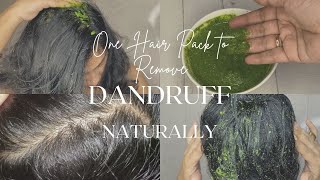 HOW TO GET RID OF DANDRUFF AT HOME in 1st Wash Remove Dandruff Permanently at Home [upl. by Pan2]