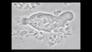 Gum disease Capping entamoeba in dental plaque biofilm Dr Mark Bonner [upl. by Basia456]