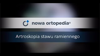 Artroskopia barku z rekonstrukcją stożka rotatorów  Nowa Ortopedia [upl. by Rfinnej]