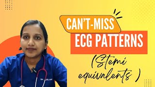 STEMI Equivalent  Cant Miss ECG Patterns [upl. by Lizbeth863]