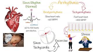 Tachycardia  Most Common causes and Symptoms [upl. by Leola441]