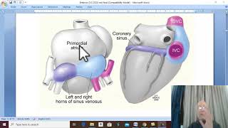 Development of CVS in Arabic 3  Development of sinus venosus   by Dr Wahdan [upl. by Tyler]