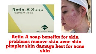 Retin A soap benefits for skin problems remove skin acne skin pimples skin damage best for acne skin [upl. by Zephaniah557]