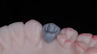 Encerado de primer premolar inferior en modelo MTJ [upl. by Magdala]