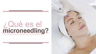 Qué es microneedling o microagujas l María Clara Mejía [upl. by Tiram]