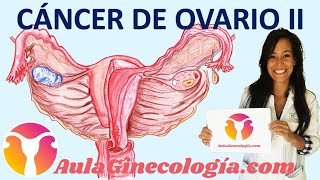 CÁNCER DE OVARIO ESTADIAJE TRATAMIENTO SEGUIMIENTO FERTILIDAD  Ginecología y Obstetricia [upl. by Elleved826]