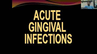 ACUTE GINGIVAL INFECTIONS  DR RISHI EMMATTY DEPT OF PERIODONTICS ROYAL DENTAL COLLEGE [upl. by Orest]