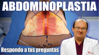 ABDOMINOPLASTÍA TODAS las RESPUESTAS 👙 Todo sobre Lipoabdominoplastía ❤️ Dr ALBERTO CALVO QUROZ [upl. by Cathyleen]