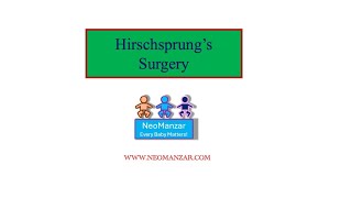 Hirschsprung’s Surgery Newborn Infant [upl. by Reinar]