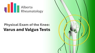 KNEE exam Varus and Valgus Tests for MCL and LCL laxity [upl. by Hoopen]