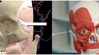 Use these Botox injection points for Crows Feet Botox Anatomy Training [upl. by Bianca920]