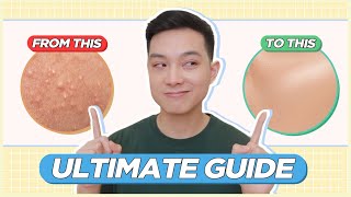 ULTIMATE GUIDE to Treat amp Prevent BLACKHEADS WHITEHEADS TINY BUMPS for FILIPINO SKIN  Jan Angelo [upl. by Heloise]