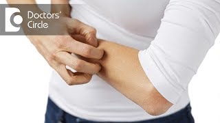 How to manage continuous itching over the body  Dr Rashmi Ravindra [upl. by Pernas]