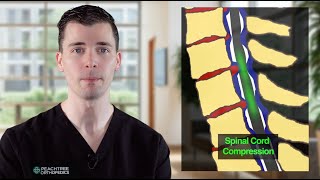 Cervical Myelopathy – Dr George Fryhofer [upl. by Meil860]