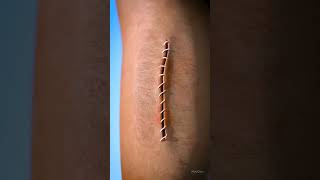 Wound healing process 3D video Shorts shorts shortsfeed funny [upl. by Dlanor41]