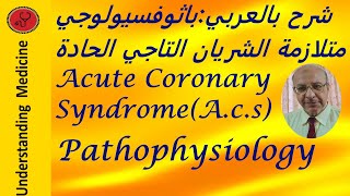 ACUTE CORONARY SYNDROME،ACS PATHOPHYSIOLOGY شرح بالعربي [upl. by Nalyt]