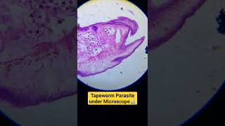 Tapeworm parasite under microscope tapeworm physicswallah biology unacademy adre [upl. by Ikkela]