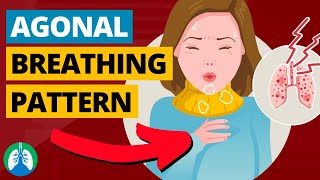 Agonal Breathing Medical Definition  Quick Explainer Video [upl. by Ttennej]