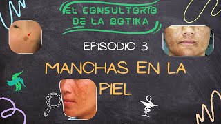 PODCAST Manchas en la piel [upl. by Vladimar]