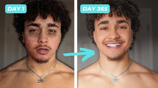 I Drank a Gallon of Water Everyday For a Year Heres What Happened [upl. by Adnilemre]