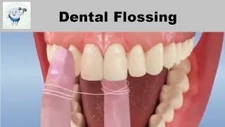 Dental Flossing Technique Animation [upl. by Sorcha]