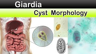 Giardia Cyst Morphology [upl. by Yrocaj182]