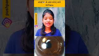 आंखों 👁️के अंदर लगाए जाने वाले lens pushpamehta shorts ytshorts [upl. by Nnayt]