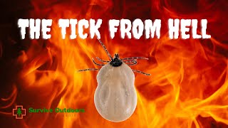 TICK BITE Case Study Ehrlichia Chaffeensis [upl. by Akram877]