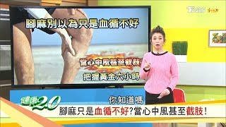 腳麻是血循環不好？每天3分鐘「健腿」保養，遠離腳中風行動更犀利！健康20 20190119完整版 [upl. by Tennek804]