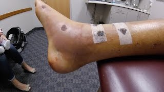 Blakelys Broken Leg  Week 4 Update  XRays [upl. by Ittak]