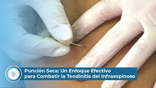 Punción Seca Un Enfoque Efectivo para Combatir la Tendinitis del Infraespinoso [upl. by Socram]