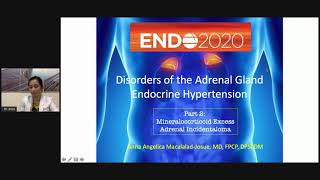 Disorders of the Adrenal Gland Part 3 Mineralocorticoid excess and Adrenal incidentaloma [upl. by Vachel774]