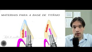 Zircônia e Dissilicato sobre o Tibase [upl. by Dilly]