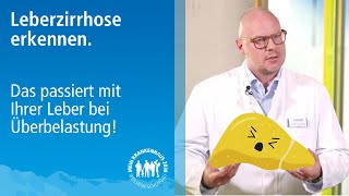 Was tun bei einer Leberzirrhose Wie können Sie eine Leberzirrhose erkennen [upl. by Tiedeman]