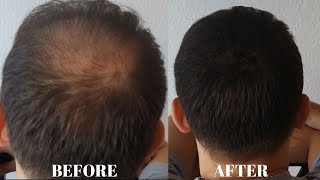 Hair Fiber Results  Is Hair Fiber Waterproof [upl. by Mitchiner]