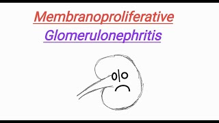 Membranoproliferative glomerulonephritis MPGN  Nephrotic Syndrome  USMLE Step1 [upl. by Ettenot856]