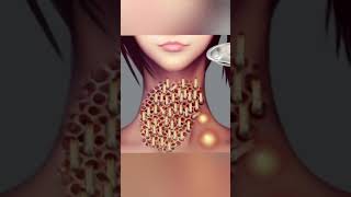 Trypophobia to the Max Animation [upl. by Hamilah1]