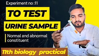 To test urine sample for normal and abnormal constituents class11thbiology [upl. by Robena]