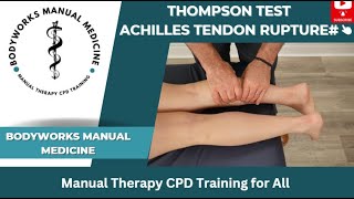 Thompson Test for Ruptured Achilles Tendon [upl. by Aramenta572]