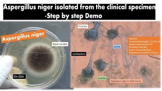 Aspergillus niger Isolation from clinical sapmle Steps [upl. by Parks504]