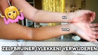 ZELFBRUINER VLEKKEN VERWIJDEREN  REVIEW BONDI SANDS TAN REMOVER [upl. by Arihaj]