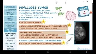 Benign breast conditions  pathology review  Osmosis [upl. by Nottarts]