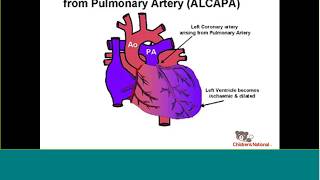 Success with failure recognizing the signs of pediatric heart failure [upl. by Mor]