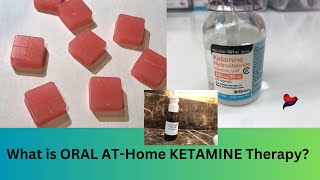 I tried oral ketamine for depression  At home ketamine therapy using oral ketamine troches [upl. by East789]