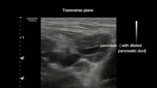 Extrahepatic cholestasis in a cat [upl. by Elatnahs]