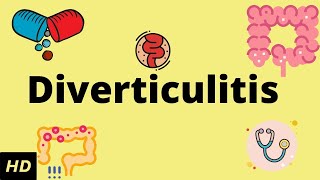 Diverticulitis Causes SIgns and Symptoms Diagnosis and Treatment [upl. by Llehcim]