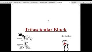 Trifascicular block Dr Akif Baig [upl. by Lamag549]