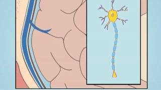 Understanding Diffuse Axonal Injury [upl. by Caril]