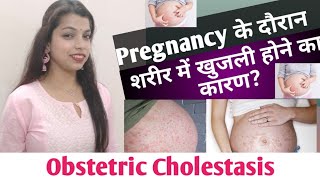 obstetric cholestasis during pregnancy  obstetric cholestasis [upl. by Ahsena26]