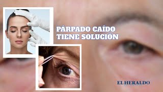 CódigoSalud  Párpado caído ¿Qué es en qué consiste la cirugía y cuánto cuesta [upl. by Elehcin]